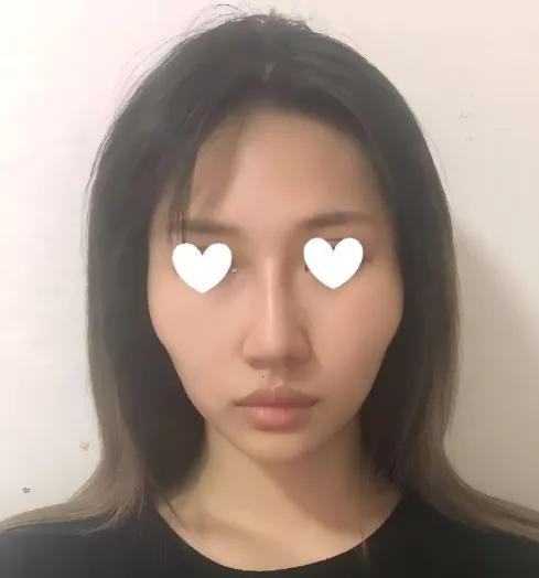 脸颊凹陷的脸型要怎么改善,脸型凹陷颧骨突出