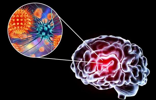 切尔诺贝利抗辐射真菌,切尔诺贝利发现的真菌