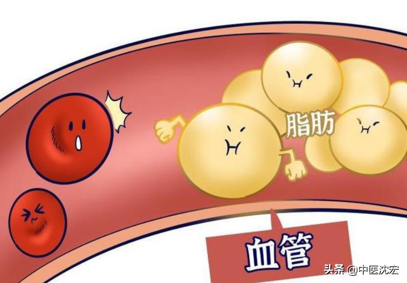 脂肝丸组成,脂肝丸效果