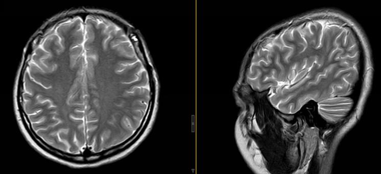 困扰多年实际很好治的病,困扰多年的几个问题