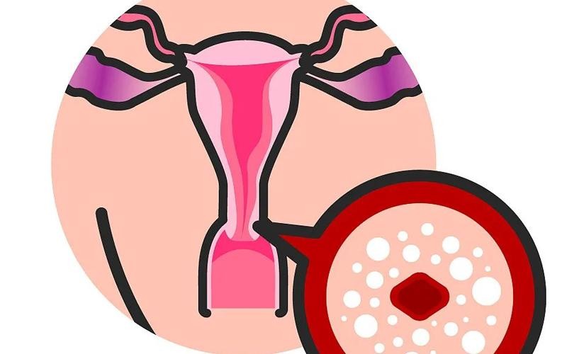 13岁女孩肠痉挛怎么回事,13岁女孩肠痉挛犯了怎么办