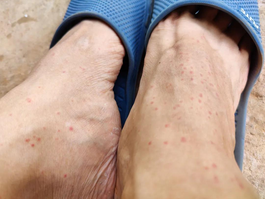 集中营六记,集中营逃亡7年