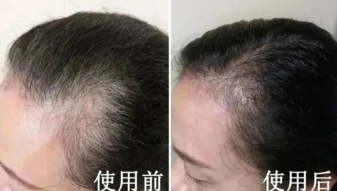 淘米水让白发变黑发吗,淘米水洗发水真的能让白发变黑吗