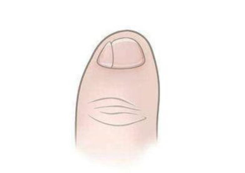 华夏子孙的3个印记：门牙、褶子和脚趾，与生俱来且无法抹去