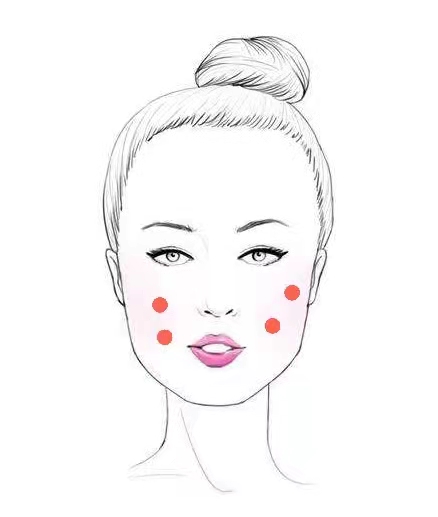 女人脸上有痘痘是什么原因造成的,脸上出痘痘的位置图解