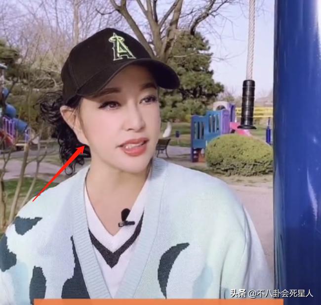 哪个女明星整容脸部变僵硬,整容脸vs自然脸的明星老去