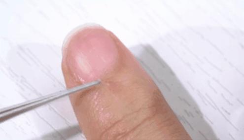 手指长倒刺缺乏哪种维生素,宝宝手指倒刺是缺什么维生素