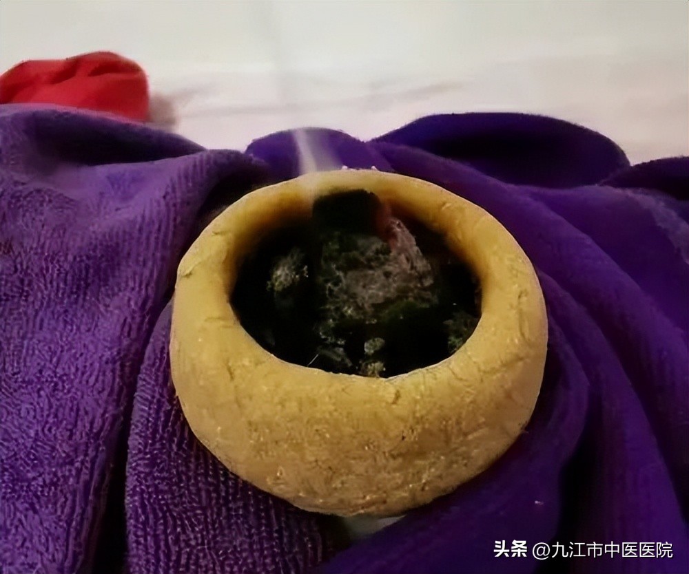 三伏养生灸团购,三伏灸惠民免费活动