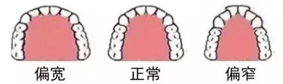 国民初恋毁容了,国民初恋盛世美颜