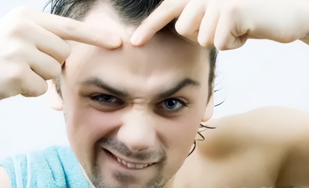 男生祛痘反复长痘怎么办,男生额头长痘什么原因引起