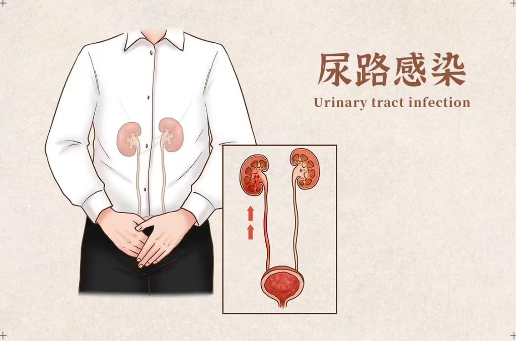 男子携妻小去水上乐园后感染“难言之隐”？夏天还能安全玩水吗？