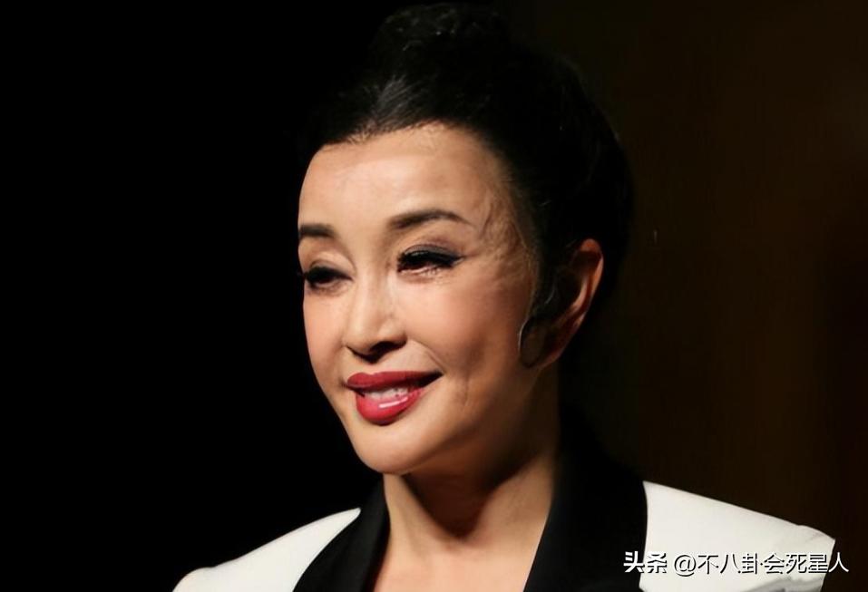 拉皮的女明星后遗症,拉皮失败的明星