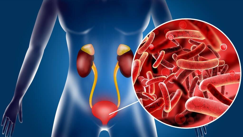 肾积水是会造成什么后果,肾积水能引起什么后果