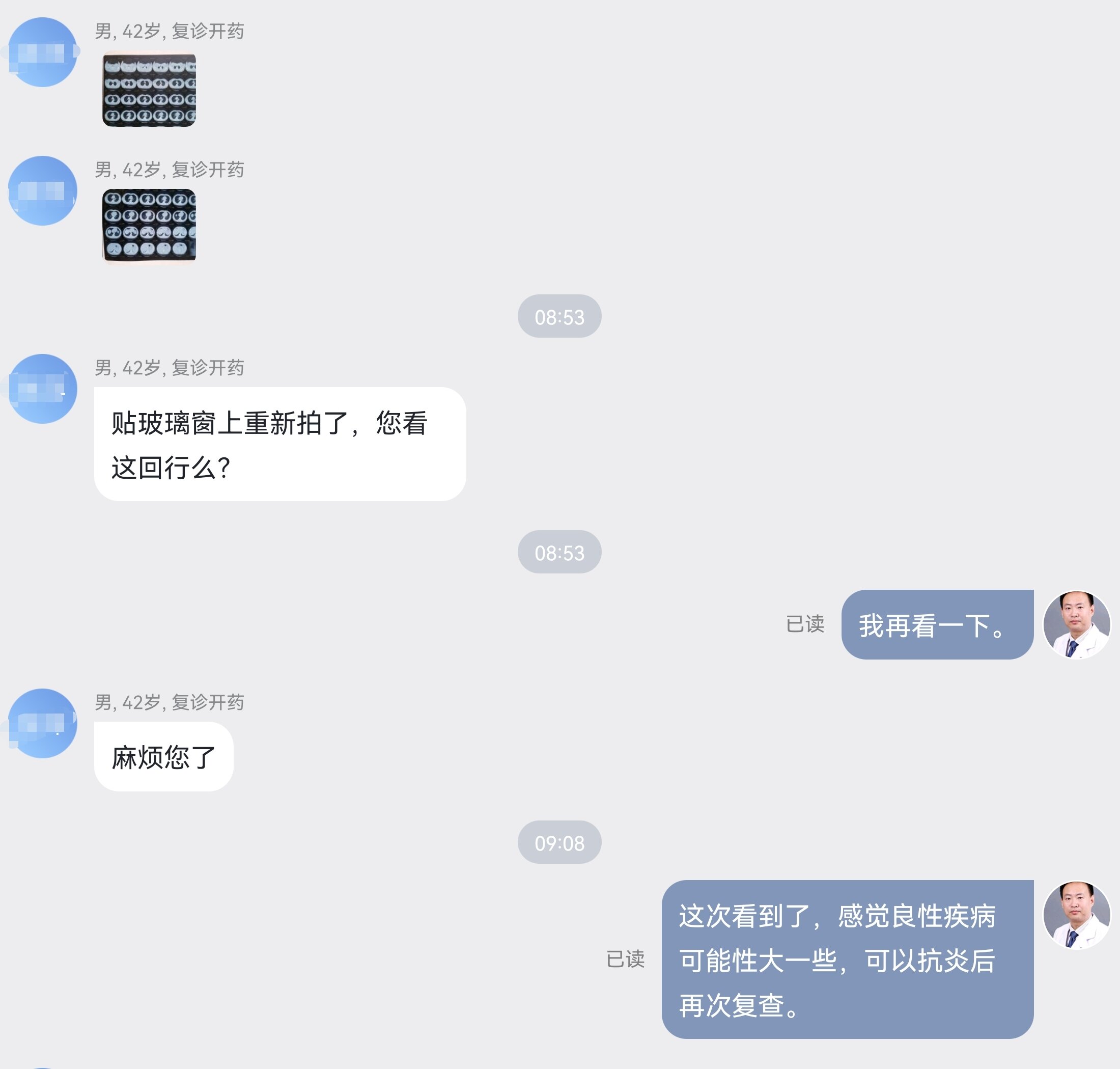 刘懿博士肺癌晚期症状,刘懿博士肺癌术后半年