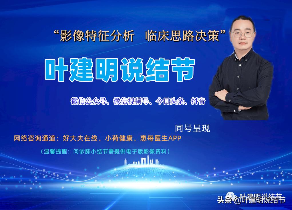 2cm的肺磨玻璃结节如何处理最合适,年轻女人磨玻璃结节