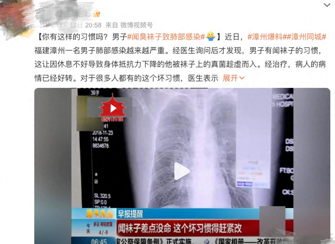 好变态啊,竟有超过91%的人爱闻自己身上这个部位