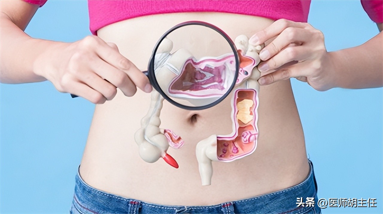 为什么肠道会长息肉,为什么肠道容易长息肉