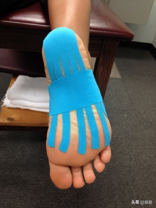 足底筋膜炎久治不愈怎么办,为什么足筋膜炎久治不愈