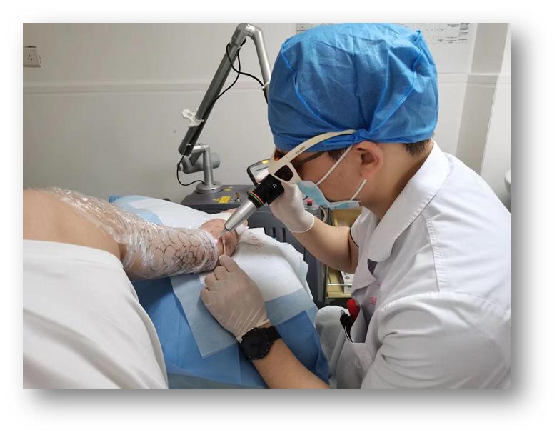 调q激光祛纹身的效果,有什么方法可以快速消除纹身