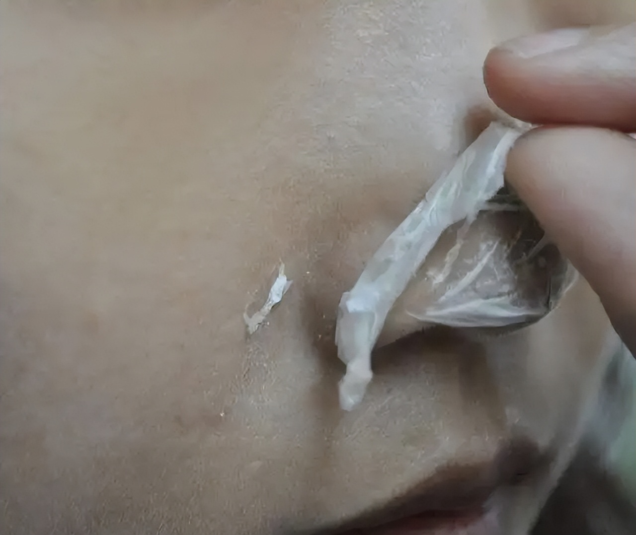 伊姿佰5个小窍门教你轻松去除黑头，告别粗糙肌肤！