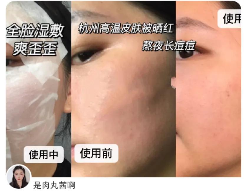 敏感肌比较适合的护肤品,有哪些适合敏感肌使用的护肤品