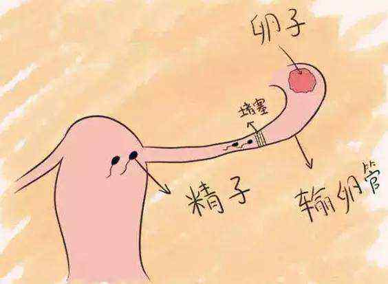 备孕时期，左等右等宝宝总不来，可能是被堵在输卵管了