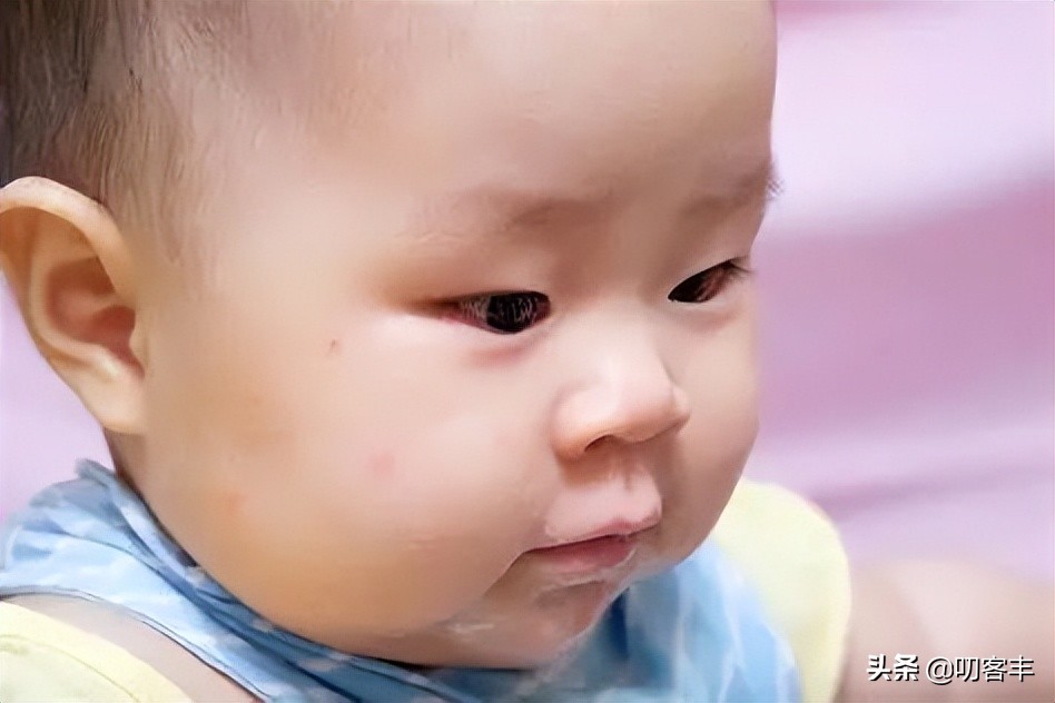 孩子痱子有什么特效药,孩子脸上长了很多小颗粒像痱子
