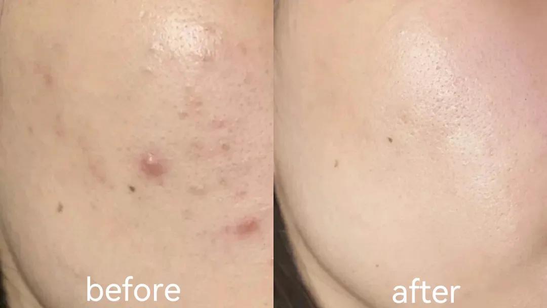 给大家推荐一款好用的洁面,大家都在用的洁面推荐