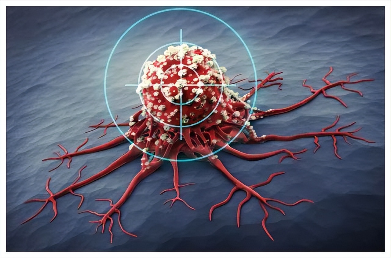癌症患者临死前的8个征兆,癌症患者自述生病诱因