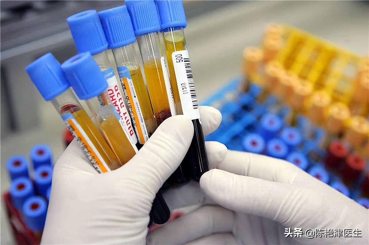 哪些检查项目没必要做,医生提醒这5件事要少做