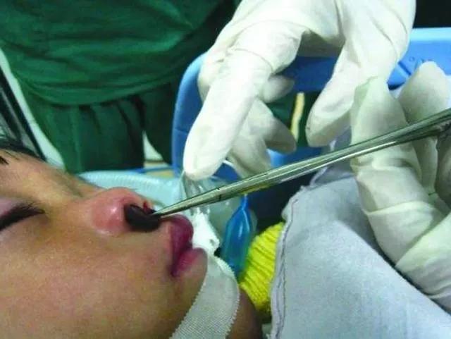 如果水蛭接触到沙子会怎么样,如果水蛭钻人血管会怎样