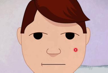 痘痘是怎么引起的如何有效祛痘,痘痘反复长教你如何祛痘简单有效