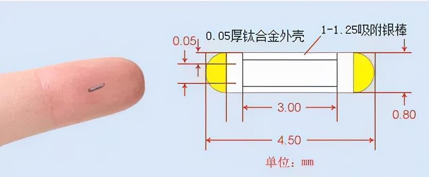 粒子植入术：一根针“排兵布阵”，精准剿灭癌细胞