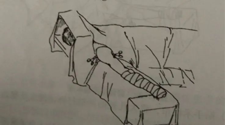 外科手术消毒、铺巾操作，做好这几个细节事半功倍