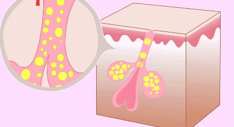 油皮护肤思路和方法,油皮晚间护肤步骤教程