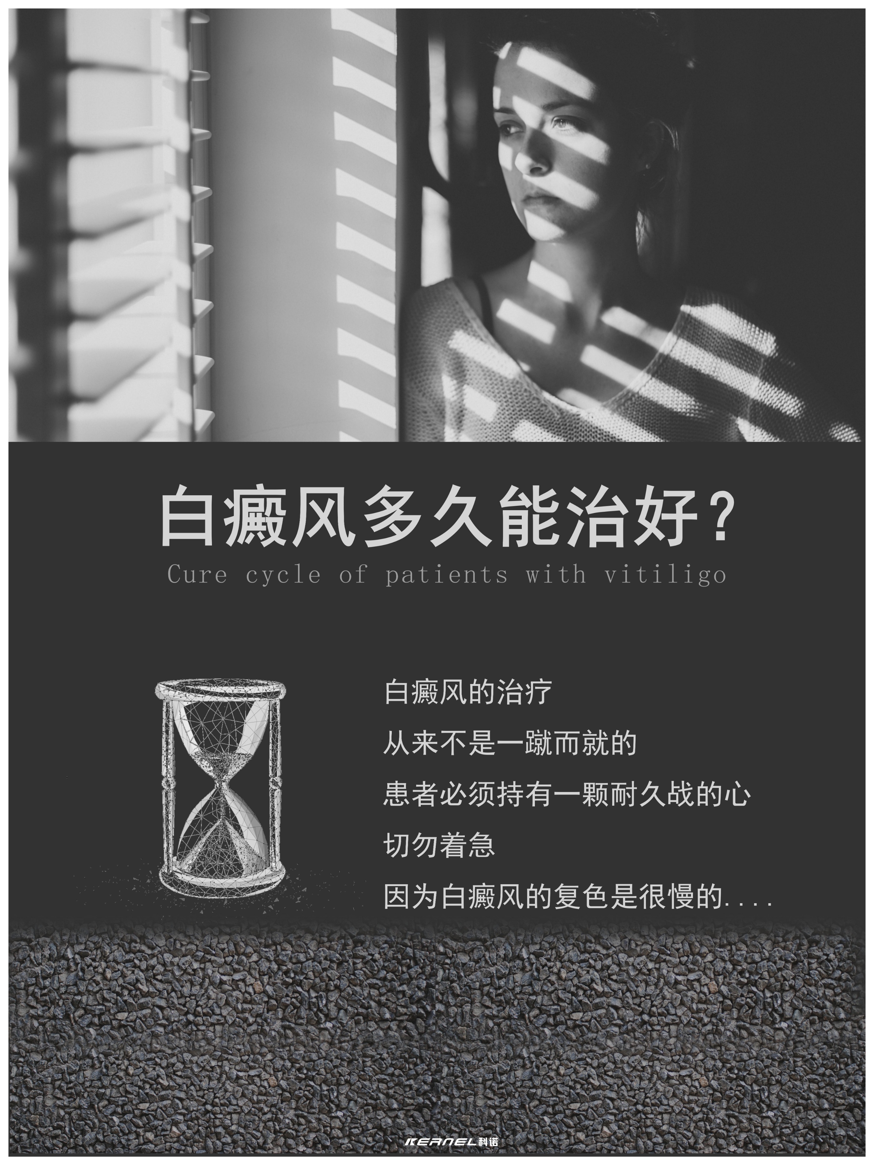 得了白癜风,多久能治好呢?