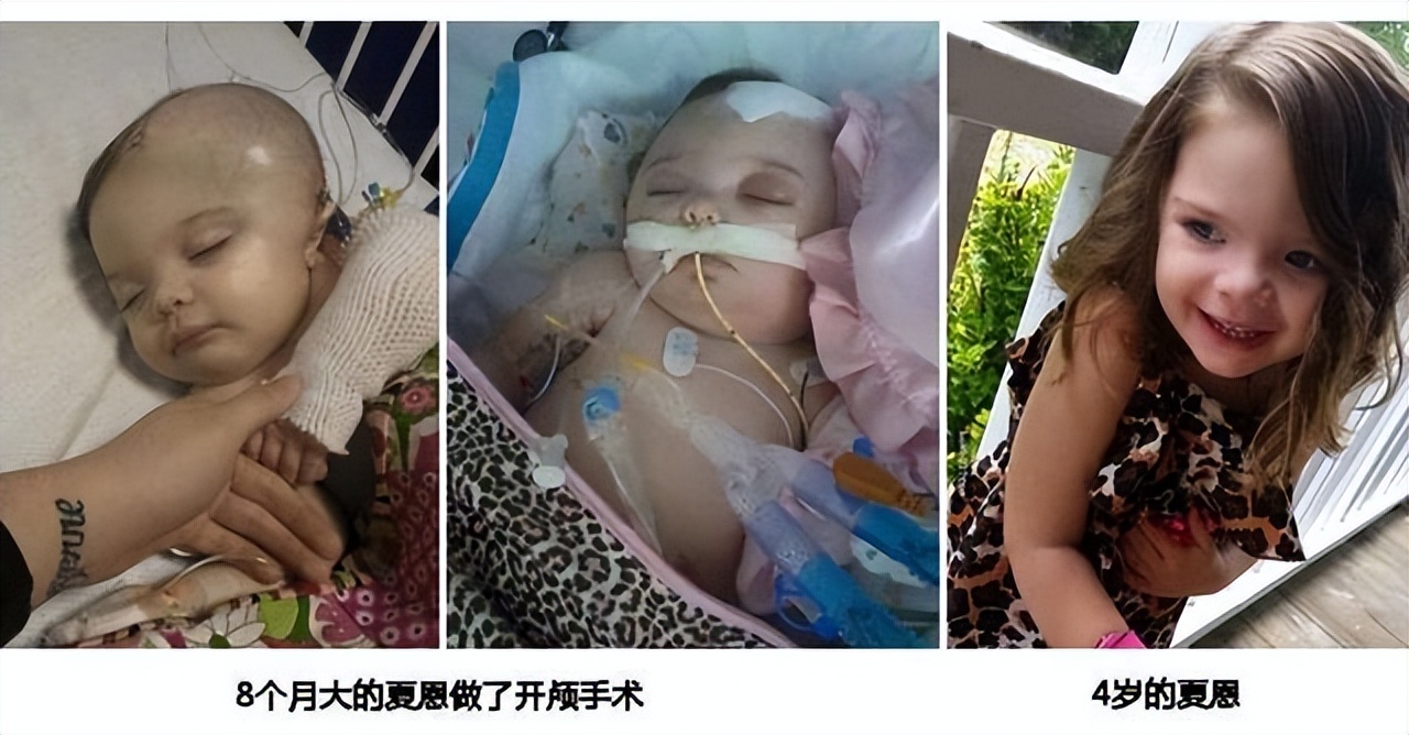 新手妈妈带娃焦虑如何缓解,新手爸妈带娃的各种焦虑