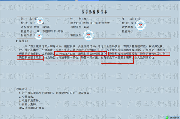 直肠癌5cm该不该保肛？广药三院彭齐荣教授：看治疗方式