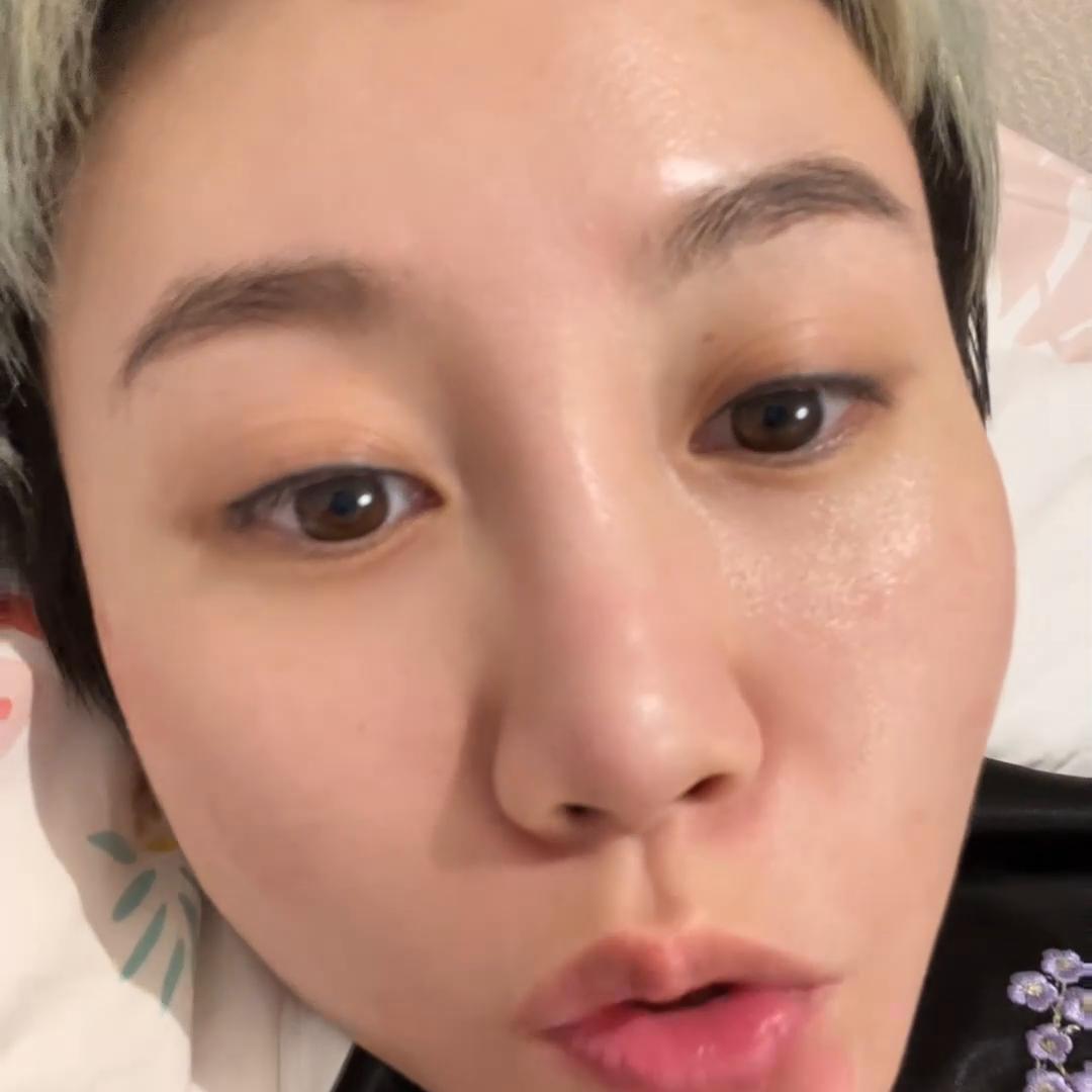 30岁容易长痘用什么洗面奶,30岁脸上突然长痘怎么回事