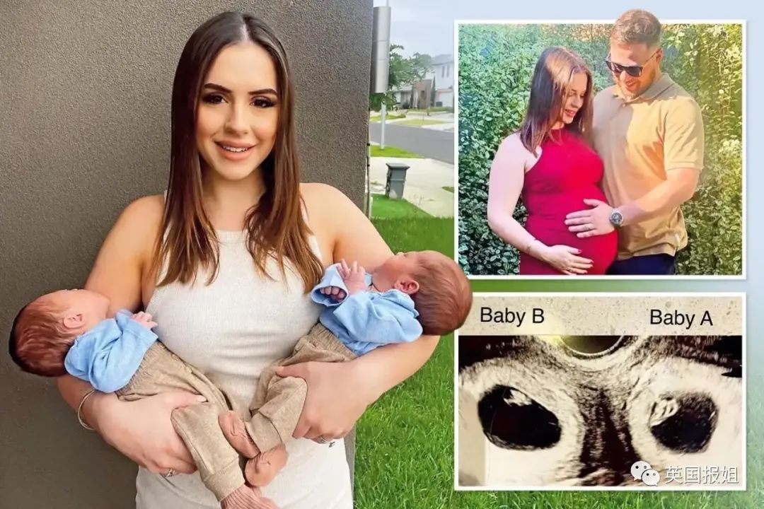 女子双子宫同时怀胎,双子宫妇女怀孕的几率有多少