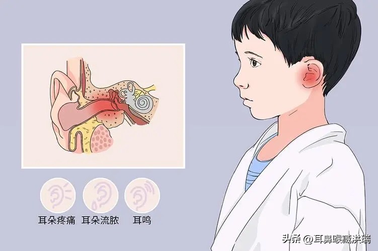耳鼻喉科鼻窦炎知识,耳鼻喉科科普文章大全