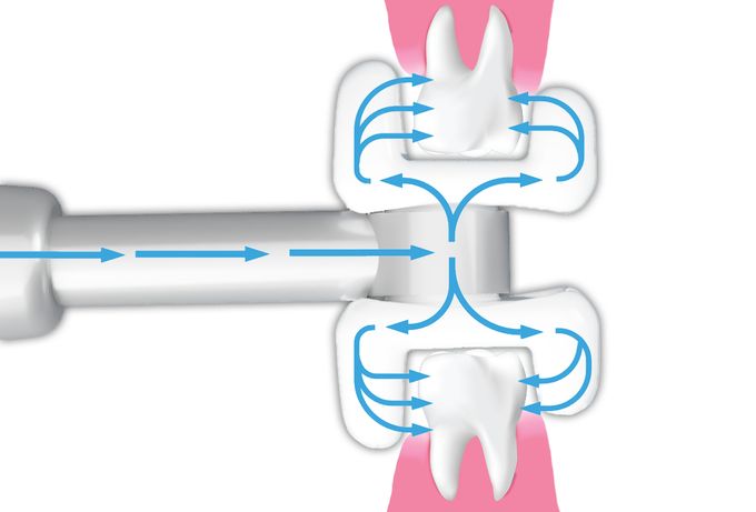 一款好的冲牙器帮你保护牙齿,洗牙神器家用口腔冲牙器