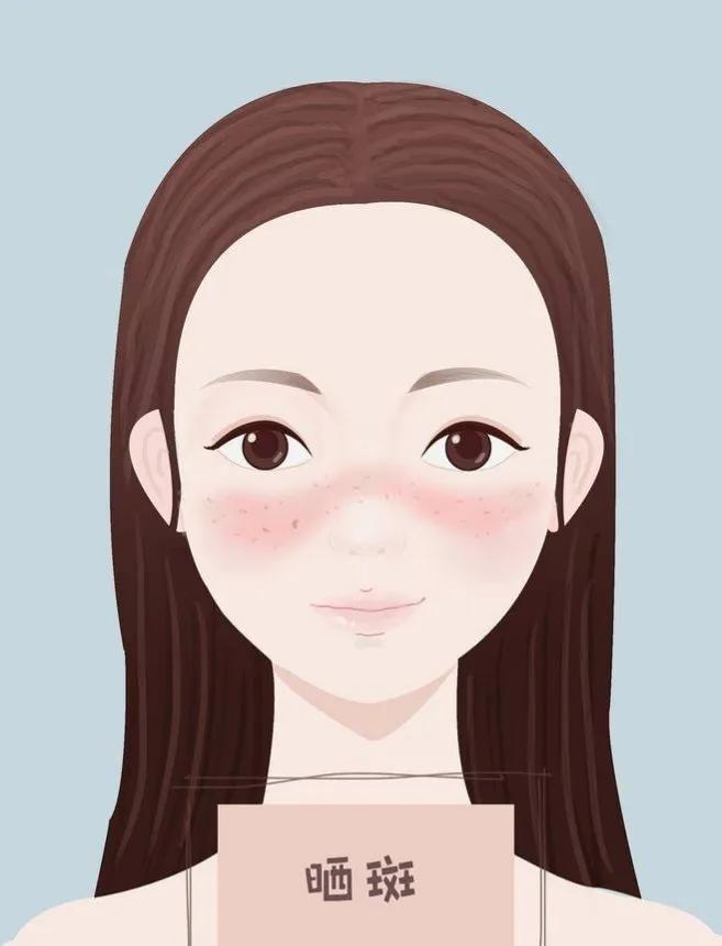 30岁脸上长斑怎么办需要注意什么,产后脸上有斑怎么办需要注意什么