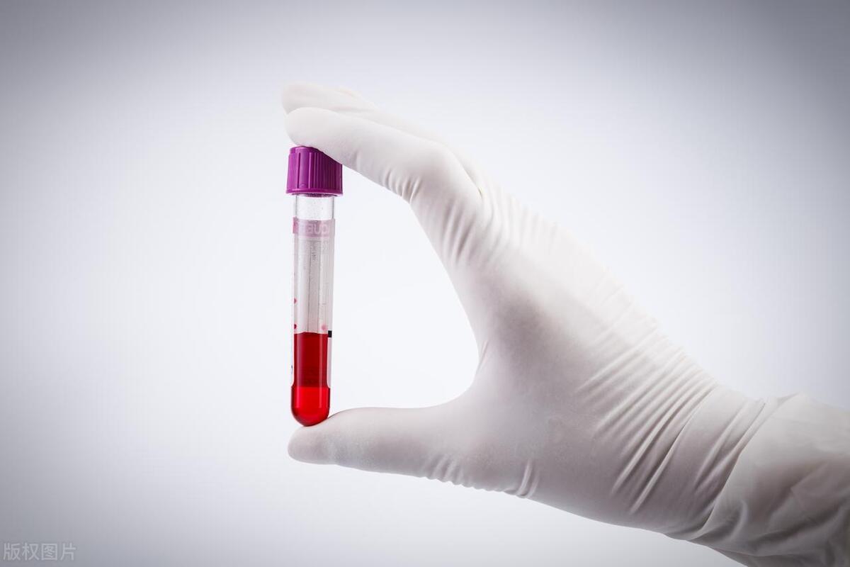 美国富豪用儿子血浆换血纪录片,亿万富豪用儿子血浆来换血