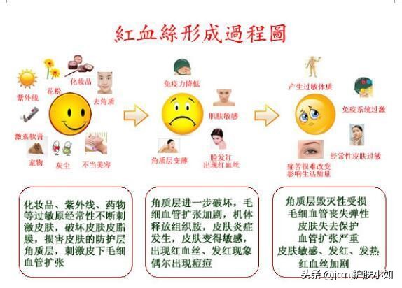 脸部红血丝怎么消除小窍门,脸部红血丝怎么去除最有效