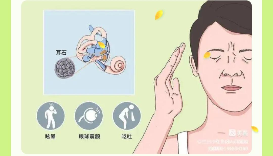 耳石症医生复位手法视频,耳石症复位神经科