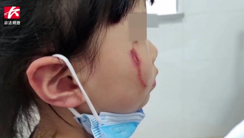 孩子碰到隐翅虫应该怎么处理,隐翅虫落在宝宝身上怎么办