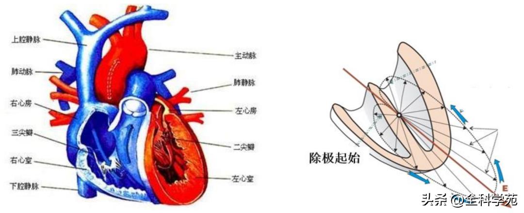 心电图笔记26：QRS波振幅变高，需要想到哪些