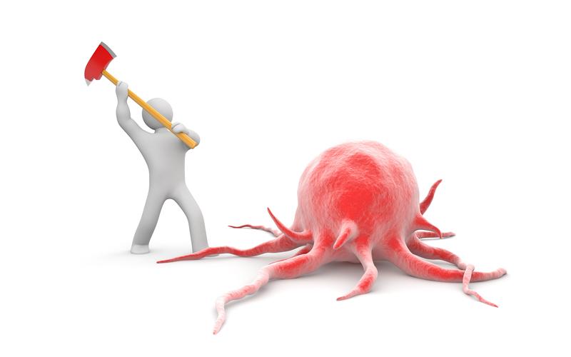 吃大蒜抗肿瘤成功案例,45岁女子吃大蒜抗肿瘤成功