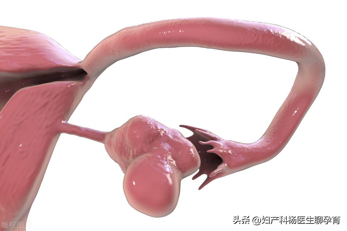 多囊卵巢会影响子宫内膜病变吗,多囊子宫内膜增生严重吗